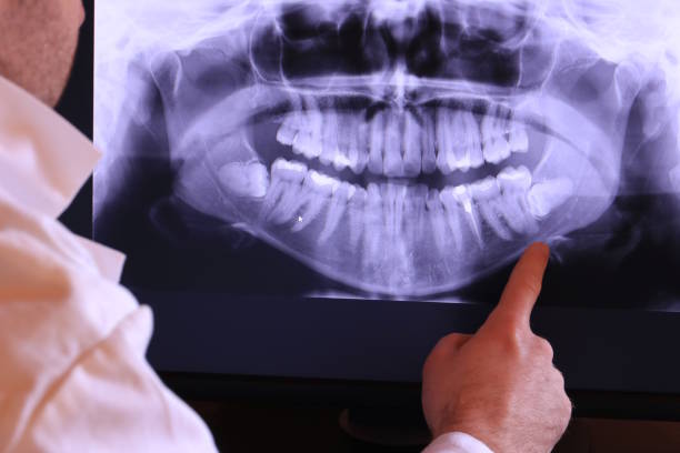 Best Emergency Gum Treatment in Frisco City, AL