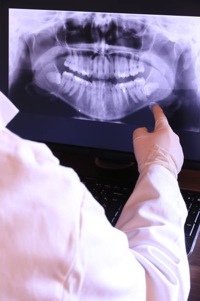 Best Emergency Tooth Extraction in Frisco City, AL
